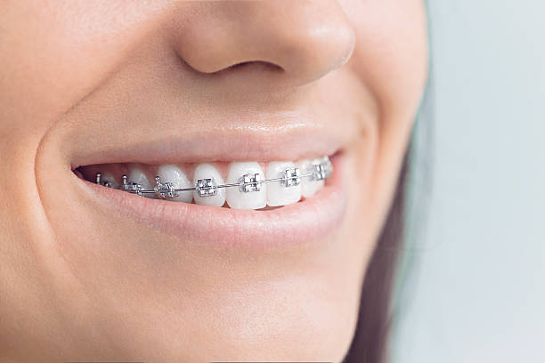Best Full Mouth Reconstruction  in Racend, LA